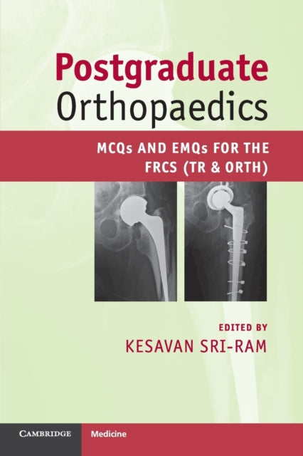Postgraduate Orthopaedics Mcqs And Emqs For The