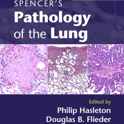 Spencers Pathology of the Lung 2 Part Set with