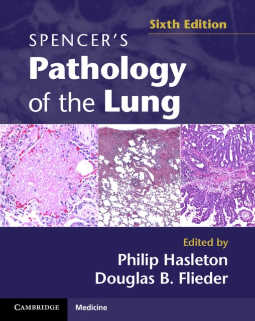 Spencers Pathology of the Lung 2 Part Set with