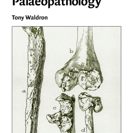 Palaeopathology Cambridge Manuals in Archaeology