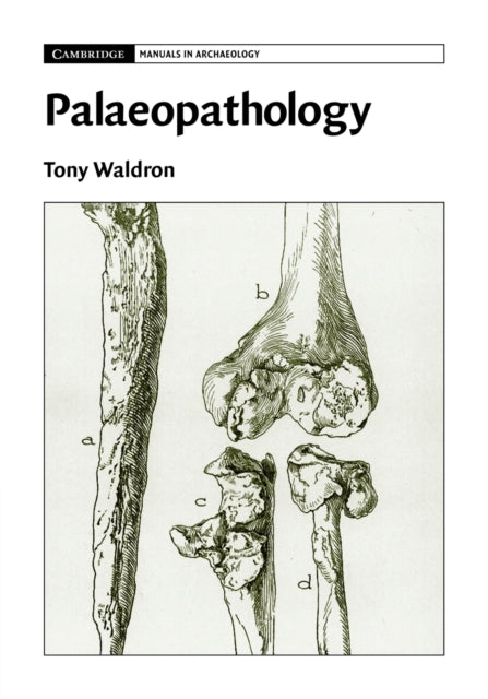 Palaeopathology Cambridge Manuals in Archaeology