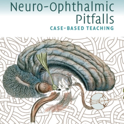 Common NeuroOphthalmic Pitfalls Casebased Teaching Cambridge Medicine Paperback