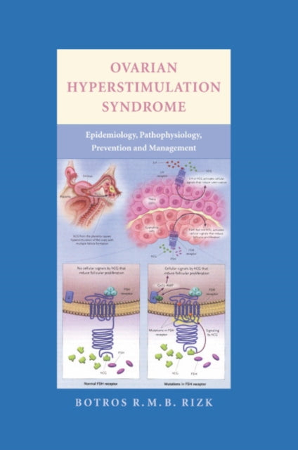 Ovarian Hyperstimulation Syndrome: Epidemiology, Pathophysiology, Prevention and Management