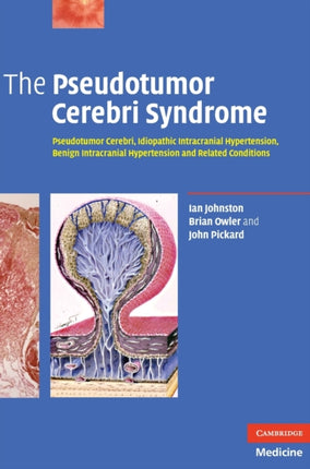 The Pseudotumor Cerebri Syndrome Pseudotumor