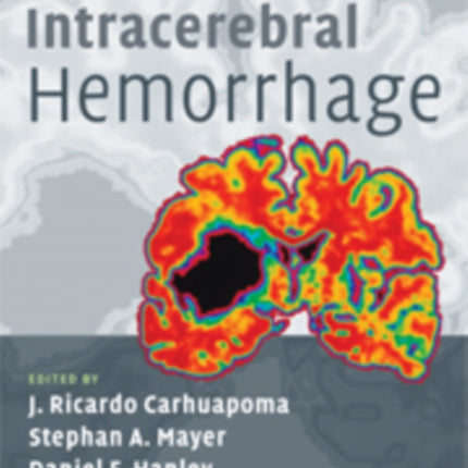 Intracerebral Hemorrhage