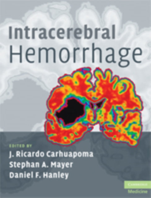 Intracerebral Hemorrhage