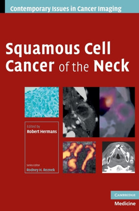 Squamous Cell Cancer of the Neck Contemporary