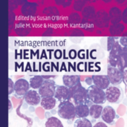 Management of Hematologic Malignancies