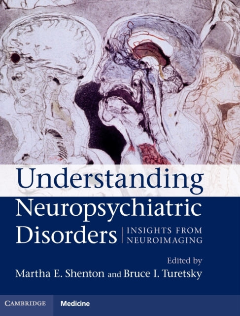 Understanding Neuropsychiatric Disorders: Insights from Neuroimaging