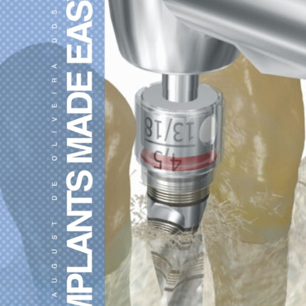 Implants Made Easy