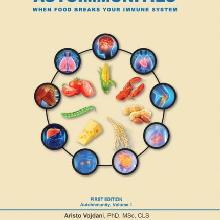 FoodAssociated Autoimmunities