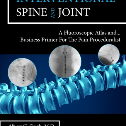 Interventional Spine and Joint A Fluoroscopic Atlas and Business Primer For The Pain Proceduralist