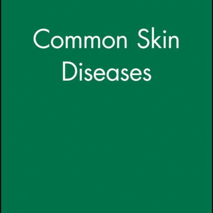 Common Skin Diseases
