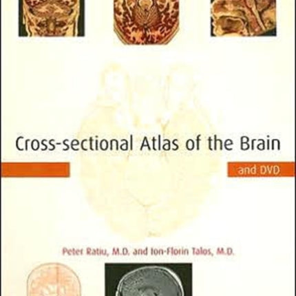 Cross-sectional Atlas of the Brain and DVD