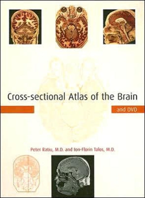 Cross-sectional Atlas of the Brain and DVD