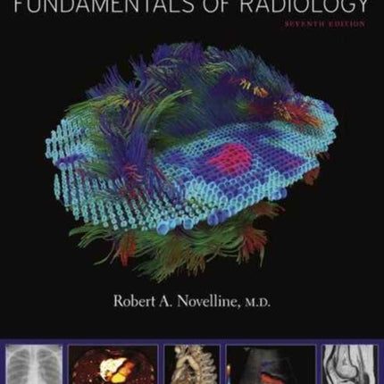 Squire’s Fundamentals of Radiology: Seventh Edition