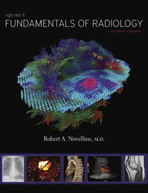 Squire’s Fundamentals of Radiology: Seventh Edition