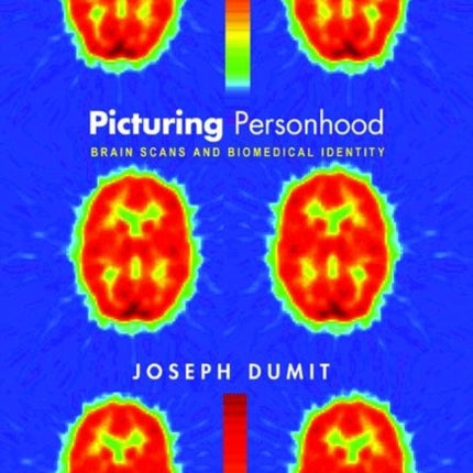 Picturing Personhood: Brain Scans and Biomedical Identity