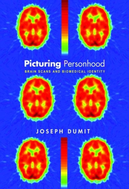 Picturing Personhood: Brain Scans and Biomedical Identity