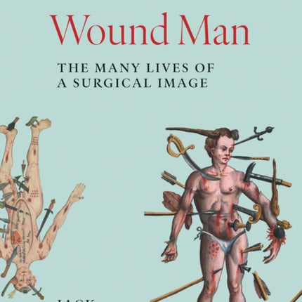 Wound Man