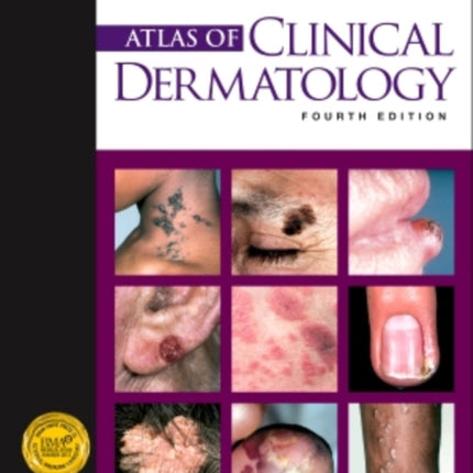 Atlas of Clinical Dermatology