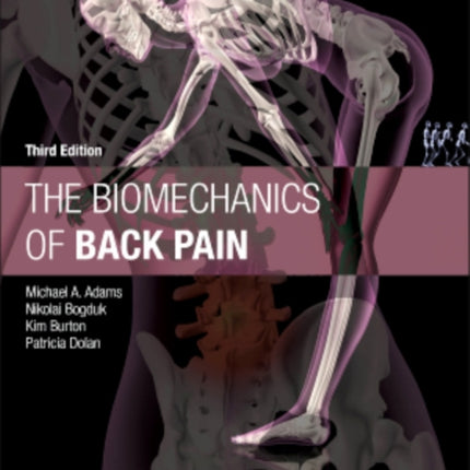 The Biomechanics of Back Pain