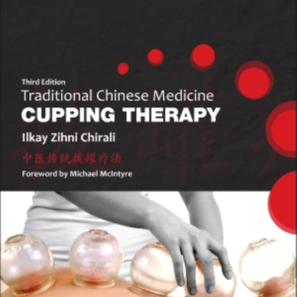 Traditional Chinese Medicine Cupping Therapy