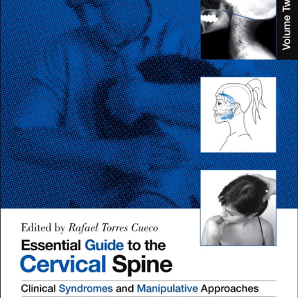 Essential Guide to the Cervical Spine - Volume Two: Clinical Syndromes and Manipulative Treatment