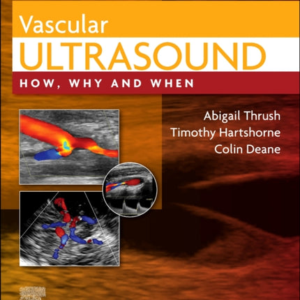 Vascular Ultrasound