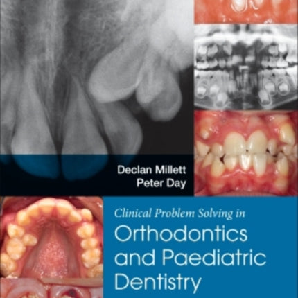 Clinical Problem Solving in Dentistry: Orthodontics and Paediatric Dentistry