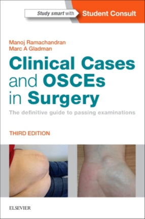 Clinical Cases and OSCEs in Surgery: The definitive guide to passing examinations