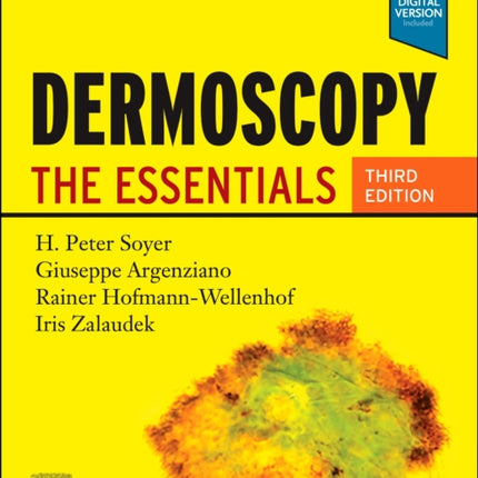 Dermoscopy: The Essentials