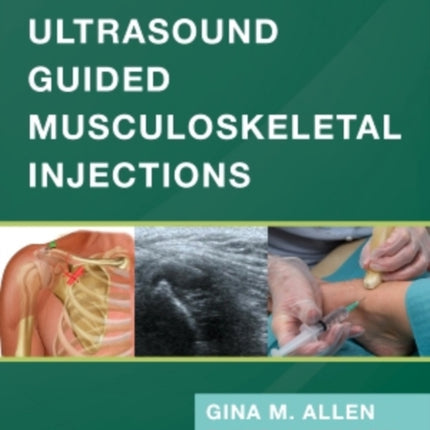 Ultrasound Guided Musculoskeletal Injections