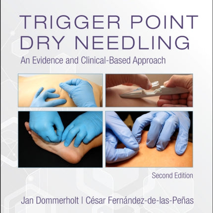 Trigger Point Dry Needling: An Evidence and Clinical-Based Approach