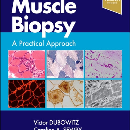 Muscle Biopsy: A Practical Approach