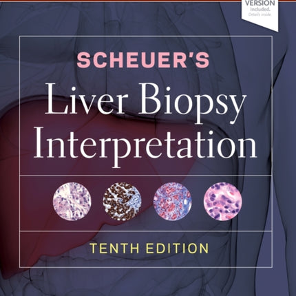 Scheuer's Liver Biopsy Interpretation