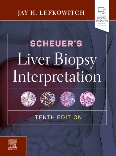 Scheuer's Liver Biopsy Interpretation