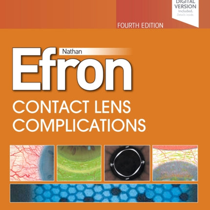 Contact Lens  Complications