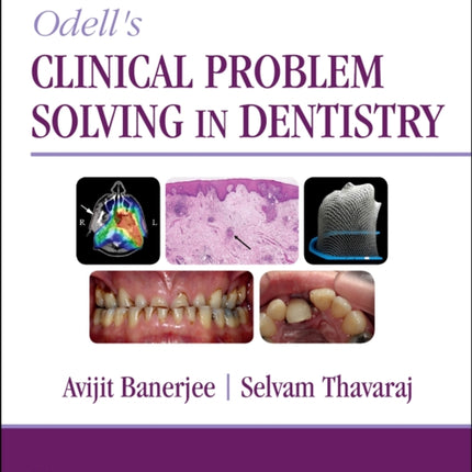 Odell's Clinical Problem Solving in Dentistry