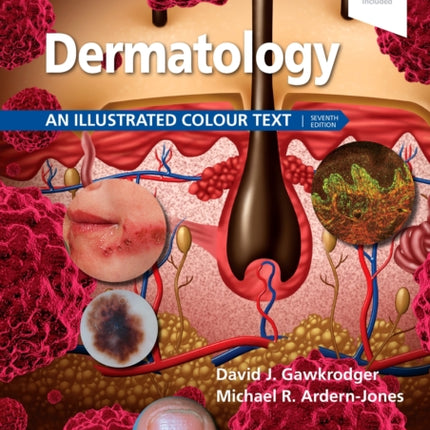 Dermatology: An Illustrated Colour Text