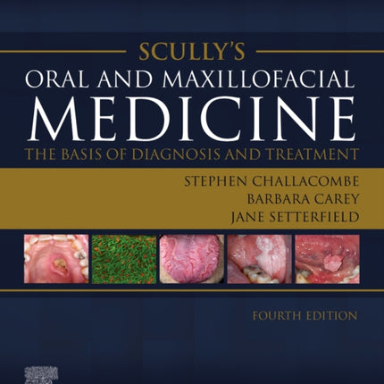 Scully's Oral and Maxillofacial Medicine: The Basis of Diagnosis and Treatment: The Basis of Diagnosis and Treatment