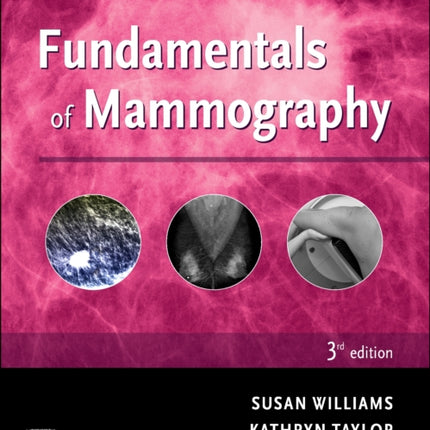 Fundamentals of Mammography