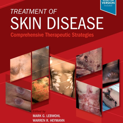 Treatment of Skin Disease: Comprehensive Therapeutic Strategies