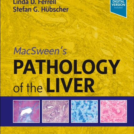 MacSween's Pathology of the Liver