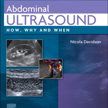 Abdominal Ultrasound: How, Why and When