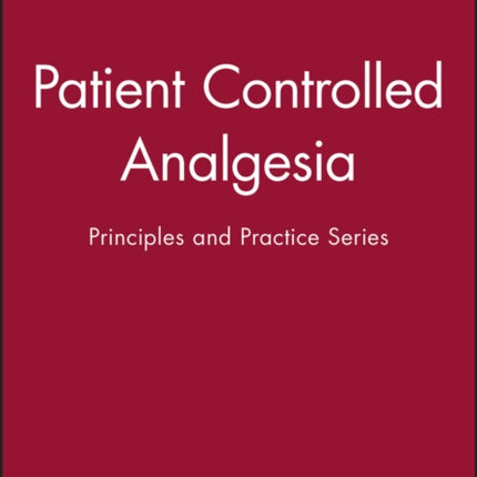 Patient Controlled Analgesia  Principles and