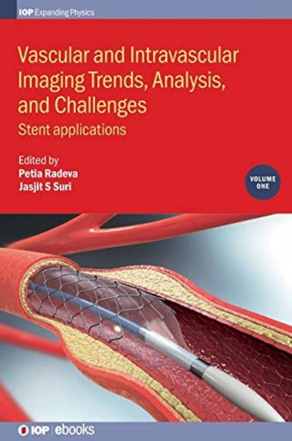 Vascular and Intravascular Imaging Trends