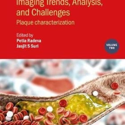 Vascular and Intravaslcular Imaging Trends