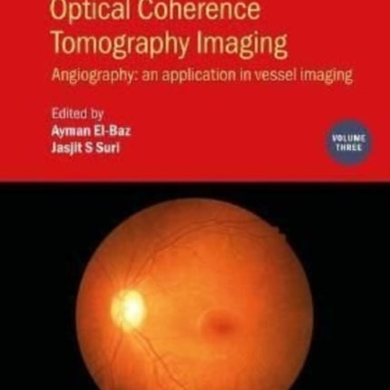 Photo Acoustic and Optical Coherence Tomography