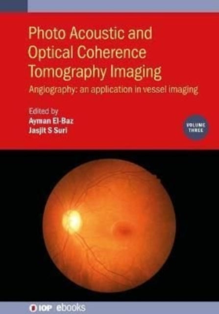 Photo Acoustic and Optical Coherence Tomography